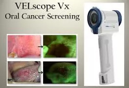 Oral Cancer Screen