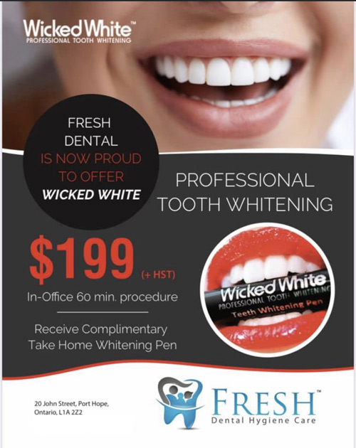 Wicked White Teeth Whitening